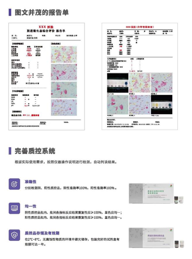 阴道分泌物91视频免费看片V800报告单