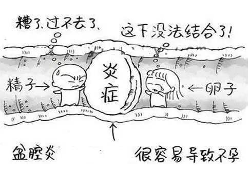 全自动妇科阴道分泌物91视频免费看片检测辨别妇科炎症复杂多样！